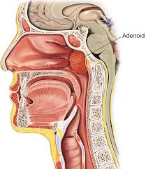 How much does a tonsillectomy cost? Adeno Tonsillectomy Child Healthdirect