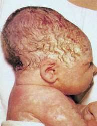 Check spelling or type a new query. ì‹ ìƒì•„ ì§ˆë³' ë‚˜ë¬´ìœ„í‚¤