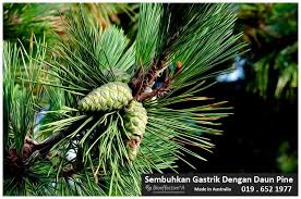 Bagi pedagang, menyusun dan menghitung harga pokok penjualan (hpp) adalah suatu hal yang pengertian harga pokok penjualan sendiri, menurut prinsip akuntansi indonesia dapat dijelaskan. Ubat Gastrik Mujarab Daun Pokok Pine Penyembuh Gastrik Berkesan Dalam 7 Hari Atau Wang Dikembalikan Sms Gastrik Ke 019 6521977 Pakar Penyembuhan Gastrik Made In Australia Lulus Kkm Mal 09062186