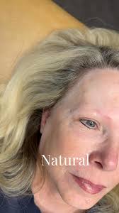 She was torn between nano and combo brows, but after discussing her desired  look and considering her lack of natural brow hair, we decided that nano  brows were the perfect choice—and she couldn’t be ...