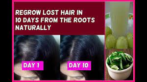 I have done it and so can you! Regrow Lost Hair In 10 Days From The Roots Guaranteed No Hair Loss And Fast Hair Growth Youtube
