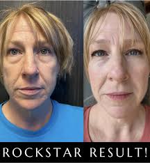 Sanctuary Clinic Scottsdale (@sanctuaryclinicscottsdale) • Instagram photos  and videos