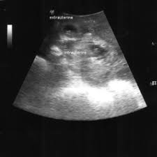 It is located in bukit jalil, 20 km south of kuala lumpur. Zainul Rashid Mohd Razi S Research Works Kuala Lumpur Sports Medicine Centre Kuala Lumpur And Other Places