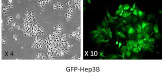GFP-Human Liver Carcinoma Cells (Hep3B)-Angio-Proteomie