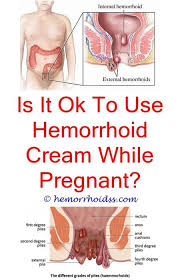 Pin On Sitz Bath For Hemorrhoid