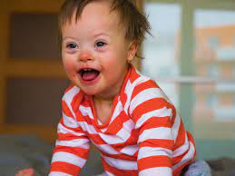 And not just this, a lot of research programs, specialized outpatient services, and early intervention programs are also conducted and coordinated here. Das Etwas Andere Kind Zm Online