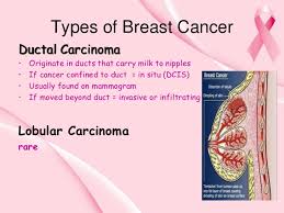 After a while, they start to form a growth, referred to as a tumor. Most Common Types Of Breast Cancer New Research Breast Cancer Daily
