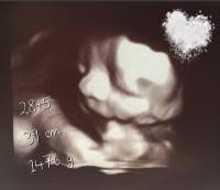 Größe und entwicklung des embryos: Grosse Und Gewicht 29 Ssw Forum Schwangerschaft Urbia De