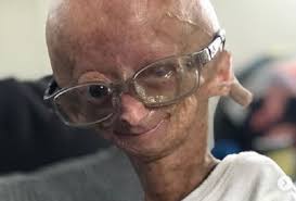 Adalia Rose Wiki Age Height Weight Biography Family More