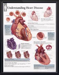 Understanding Heart Disease Chart 22x28 Ischemic Heart Disease Heart Disease Medical Dental