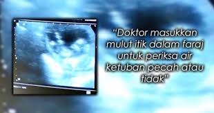 Dah Masukkan Mulut Itik Dirobek Robeknya Kita Seperti Ayam Suami Countries Around The World World Around The Worlds