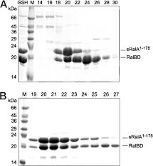 Gabriela toscano was born on october 25, 1965 in montevideo, uruguay as gabriela rosana toscano. Effector Recognition By The Small Gtp Binding Proteins Ras And Ral Journal Of Biological Chemistry
