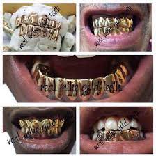 Some people want gold teeth in order to replace or repair their decaying ones; Real Mike Gold Teeth Home Facebook