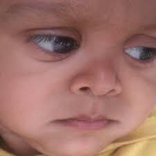 Correlation of annual changes in height age and differences between...