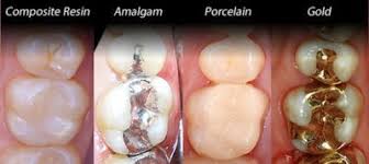 We did not find results for: Tooth Filling Procedure Cost Cavity Filling Types Nearby Dental
