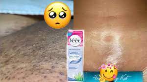 .nigerians use is the 'veet' hair removal cream. I Used Veet Hair Removal Cream To Get Rid Of Ingrown Hair Youtube