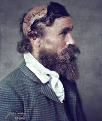 Robert McGee, scalped by Sioux Chief Little Turtle in 1864. At the age of  14 McGee was working as a teamster with H.C. Barret to transport a caravan  of flour to Fort