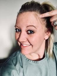 Do transmen typically only grow hair along their jaw and chin at first?