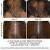 Vitamin For Hair Growth And Thickness