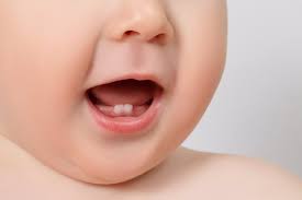 Mito O Realidad La Salida De Los Dientes Produce Fiebre En Los Bebes