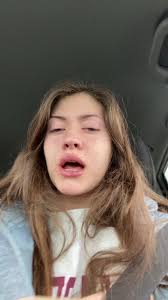 Dr Pickle Wisdom Teeth