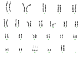 The phrase robertsonian translocation is too long for normal conversation and many people shorten it to rob. Chromosomenanalysen Allgemeine Informationen Dna Diagnostik Hamburg Gemeinschaftspraxis Fur Humangenetik Und Genetische Labore