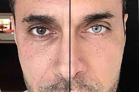 Steve 1742 views comment+changer, définitivement, la+couleur+naturelle, yeux personnel. Voici Comment Il Est Possible De Changer La Couleur De Ses Yeux Neozone