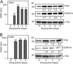 After the cancer spreads to the other parts of body, it may cause: Acute Dino Expression In Hpv Positive Cervical Cancer Cells Causes Download Scientific Diagram
