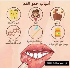 منصة الأطباء On Instagram علق ب تم ليصلك كل جديد اكتب اسم من أسماء الله الحسنى الحساب برعا Health Facts Food Health And Wellness Center Health Facts