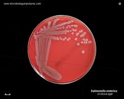 Differentiation of salmonella from the other organisms that grow on brilliance salmonella agar is achieved through the inclusion. Salmonella Culture On Blood Agar Plate Colony Morphology Of Salmonella On Blood Agar