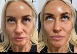 JCR Aesthetics, Joanne Rigby (@jcr_aesthetics) • Instagram photos and videos