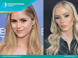 Erin Moriarty: The Truth About Plastic Surgery Rumors