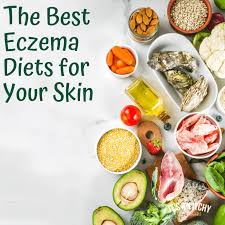 The Best Eczema Diets for Your Skin | YoRo Naturals