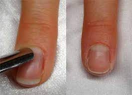 Alles was sie zu dieser maniküre anleitung brauchen sind kleine perlchen. Anleitung Nailart Mit Frenchspitzen Wunderschon