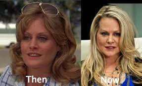 Beverly Dangelo Plastic Surgery Beverly Dangelo Plastic Surgery Beverly Dangelo Plastic Surgery Before And After Beverly Dangelo Plastic Surgery Nose Job Bev