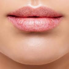 Como Hidratar Los Labios De Forma Natural