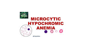 Image result for Microcytic Anemia
