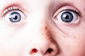 Skin cancer is a type of cancer that grows in the cells of the skin. Do You Know These 5 Signs Of Skin Cancer Might Not Be A Freckle Steemit