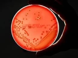 Data were extracted on june 1 st, 2017. Langzeitstudien Die Macht Der Mrsa Erreger Haz Hannoversche Allgemeine