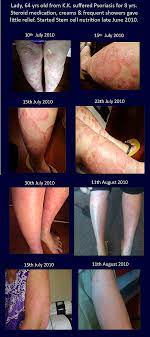 pin on testimoni pengguna afa extract