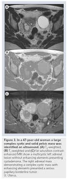 However, there are other causes for raised ca125 levels such as menstruation, endometriosis or ovarian cysts. Mri In Ovarian Cancer