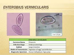 Nematodes Medical Technology Medical Laboratory Science Medical Marketing
