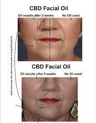 This is the potential use for cbd with the most evidence after usefulness in epilepsy, but there's a decent gap between those two, he said. Am Deborah S Collection Aloe Vera Skin Care Health Care Facebook