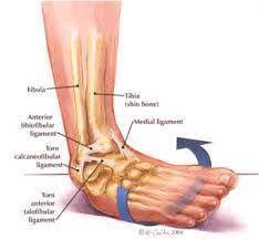 What does लाली stand for? Kecederaan Buku Lali Rehab Care Physiotherapy Centre Facebook