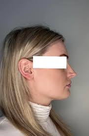 So I hear that whenever someone has a problem with their nose after surgery  that the Turkey surgeons don't care and are unresponsive to them…is this  true? And who is a surgeon