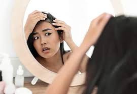When it is talked about, it is considered mysterious. How Stress Causes Hair Loss National Institutes Of Health Nih