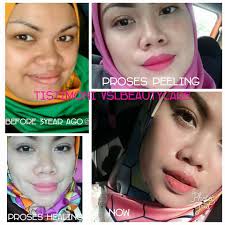 Jom guna vsl.confirm korang x menyesal. Soalan2 Cepumas Utk Vsl 1 Vsl Beauty Care Leezniel Facebook