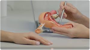 Browse tripollar before & after photos shared by doctors on realself. Side Effects Following A Hysterectomy