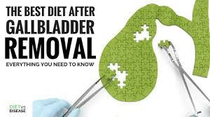 The Best Diet After Gallbladder Removal Everything You Need