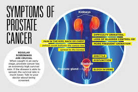 Sometimes those cells spread to other parts of the body and kill healthy tissue. Prostate Cancer And The Importance Of Early Detection Las Vegas Sun Newspaper